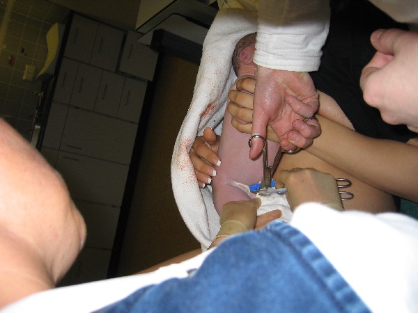 Net na de geboorte - Boudewijn knipt de navelstreng door, geplaatst door papa Boudewijn op 2004-06-03